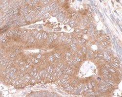 LARP1 Antibody, Novus Biologicals 0.1mL; Unlabeled:Antibodies, Polyclonal